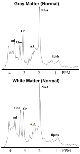 spectroscopy