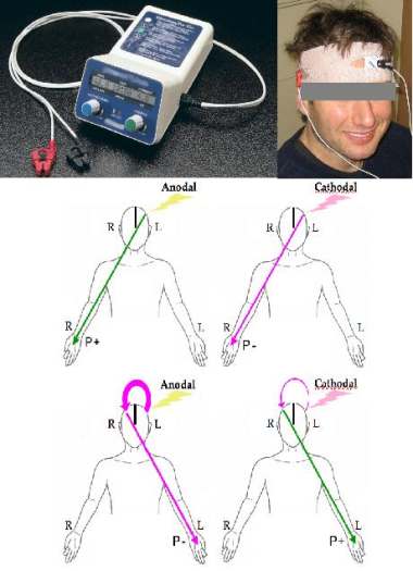 tdcs